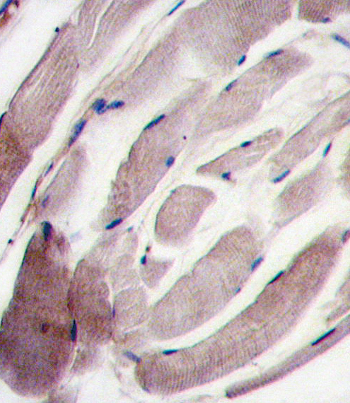Formalin-fixed and paraffin-embedded human skeletal muscle tissue reacted with the P38 gamma antibody , which was peroxidase-conjugated to the secondary antibody, followed by DAB staining. This data demonstrates the use of this antibody for immunohistochemistry; clinical relevance has not been evaluated.