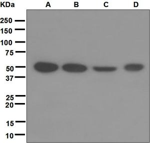 Western blot analysis on (A) 293T, (B) HeLa, (C) SW480, and (D) HT-1080 cell lysates using anti-GSS antibody.