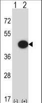 Western blot of Mapk13 (arrow) using rabbit polyclonal Mouse Mapk13 Antibody. 293 cell lysates (2 ug/lane) either nontransfected (Lane 1) or transiently transfected (Lane 2) with the Mapk13 gene.