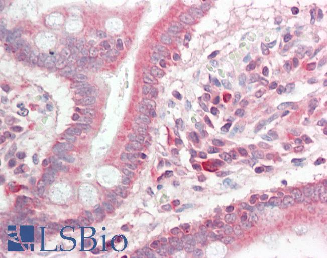 Human Small Intestine: Formalin-Fixed, Paraffin-Embedded (FFPE)