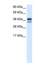 MAPK14 / p38 antibody LS-B986 Western blot of Placenta Tissue lysate. Antibody concentration 1 ug/ml.