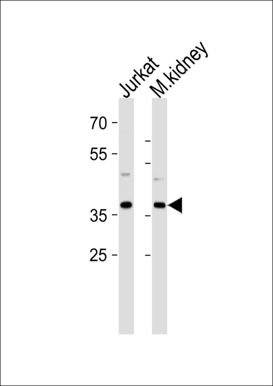 MAPK14 Antibody (Y322) western blot of Jurkat cell line and mouse kidney tissue lysates (35 ug/lane). The MAPK14 antibody detected the MAPK14 protein (arrow).