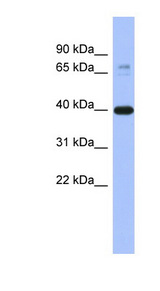 MAPK3 / ERK1 antibody LS-C111918 Western blot of Fetal Brain lysate.