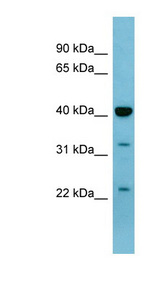 MAPK3 / ERK1 antibody LS-C107528 Western blot of Fetal Lung lysate.