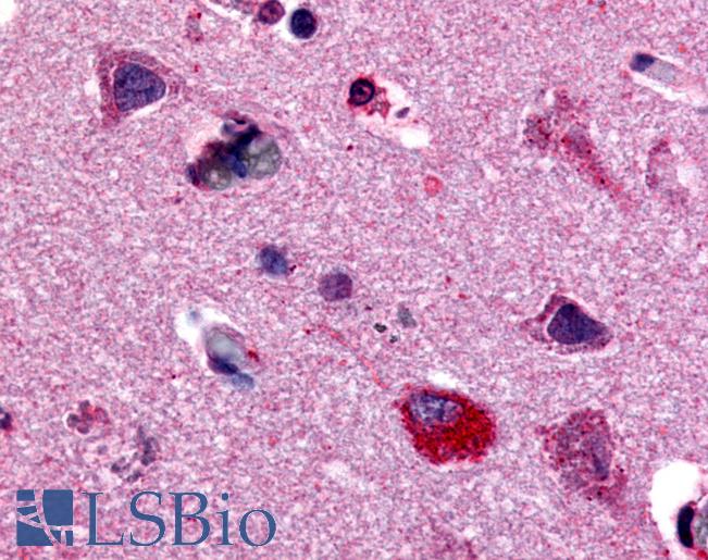Anti-MAPK3 / ERK1 antibody LS-A3520 IHC of human neurons and glia. Immunohistochemistry of formalin-fixed, paraffin-embedded tissue after heat-induced antigen retrieval.