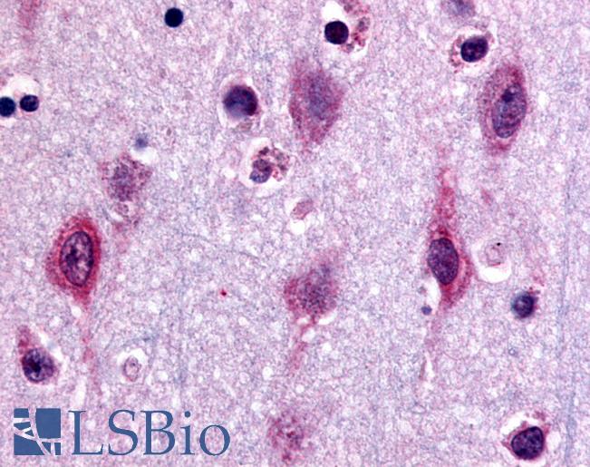Anti-MAPK3 / ERK1 antibody LS-A2877 IHC of human neurons and glia. Immunohistochemistry of formalin-fixed, paraffin-embedded tissue after heat-induced antigen retrieval.