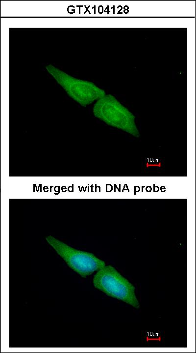 Immunofluorescence of paraformaldehyde-fixed HeLa using MAPK4 antibody at 1:200 dilution.