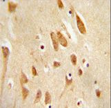 JNK1-T183/Y185 antibody immunohistochemistry of formalin-fixed and paraffin-embedded human brain tissue followed by peroxidase-conjugated secondary antibody and DAB staining.