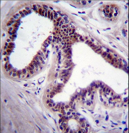 MAPK8 Antibody immunohistochemistry of formalin-fixed and paraffin-embedded human breast tissue followed by peroxidase-conjugated secondary antibody and DAB staining.
