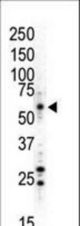 Western blot of anti-JNK1 antibody in HL60 (UV-treated) cell lysate. JNK1 (arrow) was detected using purified antibody. Secondary HRP-anti-rabbit was used for signal visualization with chemiluminescence.