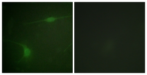 Immunofluorescence of NIH-3T3 cells, using JIP1 (Phospho-Thr103) Antibody. The sample on the right was incubated with synthetic peptide.