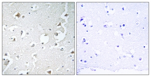 IHC of paraffin-embedded human brain tissue, using JIP1 Antibody. The sample on the right was incubated with synthetic peptide.