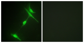 Immunofluorescence of NIH-3T3 cells, using JIP1 Antibody. The sample on the right was incubated with synthetic peptide.