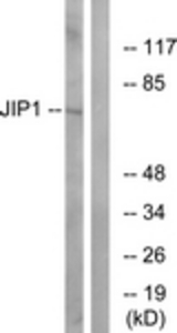 Western blot of extracts from COLO205 cells, treated with Serum 20% 15', using JIP1 Antibody. The lane on the right was incubated with synthetic peptide.