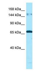 MAPK8IP3 / JIP3 antibody Western Blot of Placenta.