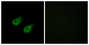 Immunofluorescence of HeLa cells, using JIP3 Antibody. The picture on the right is treated with the synthesized peptide.