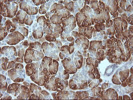 IHC of paraffin-embedded Human pancreas tissue using anti-MAPK9 mouse monoclonal antibody.