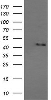 HEK293T cells were transfected with the pCMV6-ENTRY control (Left lane) or pCMV6-ENTRY MAPK9 (Right lane) cDNA for 48 hrs and lysed. Equivalent amounts of cell lysates (5 ug per lane) were separated by SDS-PAGE and immunoblotted with anti-MAPK9.