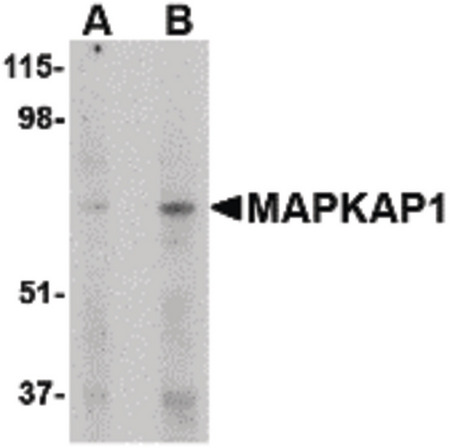 Western blot of MAPKAP1 in human skeletal muscle tissue lysate with MAPKAP1 antibody at (A) 1 and (B) 2 ug/ml.