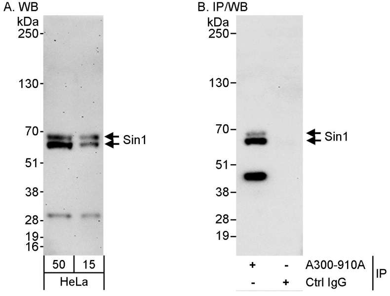 Detection of Human Sin1 by Western Blot and Immunoprecipitation. Samples: Whole cell lysate (50 and 15 ug for WB; 1 mg for IP, 20% of IP loaded) from HeLa cells. Antibodies: Affinity purified rabbit anti-Sin1 antibody used for WB at 0.1 ug/ml (A) and 1 ug/ml (B) and used for IP at 3 ug/mg lysate (B). Detection: Chemiluminescence with exposure times of 7 minutes (A) and 30 seconds (B).