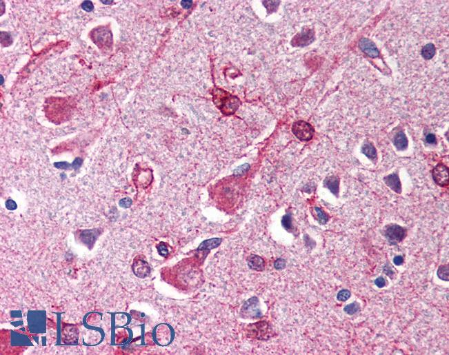 Anti-SIN1 antibody IHC of human brain, cortex. Immunohistochemistry of formalin-fixed, paraffin-embedded tissue after heat-induced antigen retrieval. Antibody LS-B585 concentration 5 ug/ml.