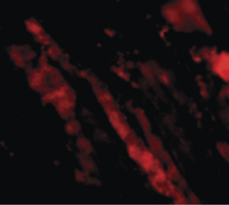 Immunofluorescence of MAPKAP1 in Human Skeletal Muscle cells with MAPKAP1 antibody at 20 ug/ml.