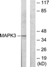 Western blot of extracts from COLO205 cells, using MAPK3 Antibody. The lane on the right is treated with the synthesized peptide.