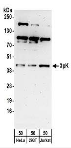 Detection of Human 3pK by Western Blot. Samples: Whole cell lysate (50 ug) from HeLa, 293T, and Jurkat cells. Antibodies: Affinity purified rabbit anti-3pK antibody used for WB at 0.4 ug/ml. Detection: Chemiluminescence with an exposure time of 3 minutes.