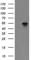 HEK293T cells were transfected with the pCMV6-ENTRY control (Left lane) or pCMV6-ENTRY GORAB (Right lane) cDNA for 48 hrs and lysed. Equivalent amounts of cell lysates (5 ug per lane) were separated by SDS-PAGE and immunoblotted with anti-GORAB.