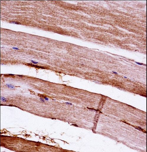 Mouse Mapkapk3 Antibody immunohistochemistry of formalin-fixed and paraffin-embedded mouse skeletal muscle followed by peroxidase-conjugated secondary antibody and DAB staining.This data demonstrates the use of Mouse Mapkapk3 Antibody for immunohistochemistry.
