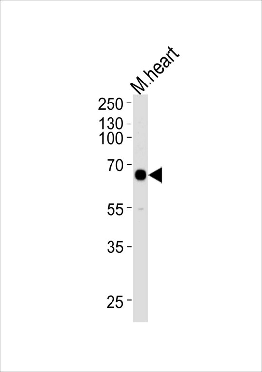 Western blot of lysate from mouse heart tissue lysate, using Mouse Mapkapk3 Antibody. Antibody was diluted at 1:1000 at each lane. A goat anti-rabbit IgG H&L (HRP) at 1:5000 dilution was used as the secondary antibody. Lysate at 35ug per lane.