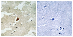 IHC of paraffin-embedded human brain tissue, using MAPKAPK5 Antibody. The sample on the right was incubated with synthetic peptide.