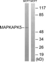 Western blot of extracts from MCF-7 cells, using MAPKAPK5 Antibody. The lane on the right was incubated with synthetic peptide.