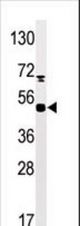 The anti-Phospho-MAPKAPK5-S93 antibody is used in Western blot to detect Phospho-MAPKAPK5-S93 in mouse heart tissue lysate. PAD4(arrow) was detected using the purified antibody.