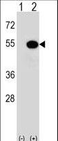 Western blot of MAPKAPK5 (arrow) using rabbit polyclonal MAPKAPK5 Antibody (T182). 293 cell lysates (2 ug/lane) either nontransfected (Lane 1) or transiently transfected (Lane 2) with the MAPKAPK5 gene.