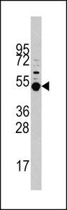 Western blot of MAPKAPK5 Antibody (T182) in HeLa cell line lysates (35 ug/lane). MAPKAPK5 (arrow) was detected using the purified antibody.