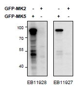 MAPKAPK5 antibody HEK293 lysate (10 ug protein in RIPA buffer) overexpressing Mouse MK5-GFP (first lane) or Mouse MK2-GFP (second lane) probed with EB11927 (0.5 ug/ml) in right panel and with (0.5 ug/ml) on left panel, Primary incubations were for 2 hours. Detected by chemiluminescence.