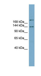 MAPKBP1 antibody LS-C111611 Western blot of Fetal Stomach lysate.
