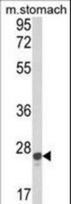 Western blot of GSTA1 Antibody in mouse stomach tissue lysates (35 ug/lane). GSTA1 (arrow) was detected using the purified antibody.