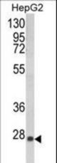 Western blot of GSTA1 Antibody in HepG2 cell line lysates (35 ug/lane). GSTA1 (arrow) was detected using the purified antibody.