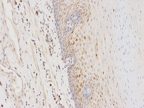 Immunohistochemistry of paraffin-embedded human esophagus using GSTA1 antibody at dilution of 1:100 (200x lens).