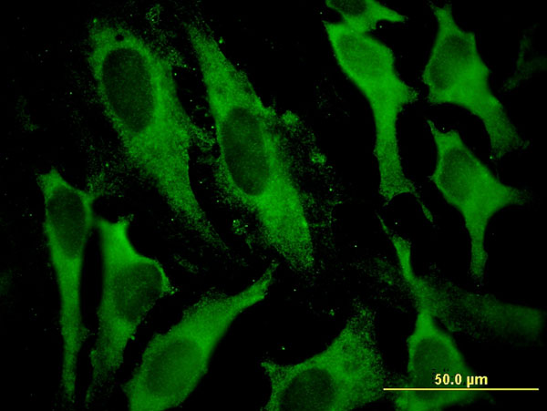 Immunofluorescence of monoclonal antibody to GSTA2 on HeLa cell . [antibody concentration 10 ug/ml]