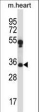 MARCH1 Antibody western blot of mouse heart tissue lysates (35 ug/lane). The MARCH1 antibody detected the MARCH1 protein (arrow).