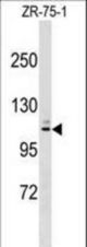 MARCH10 Antibody western blot of ZR-75-1 cell line lysates (35 ug/lane). The MARCH10 antibody detected the MARCH10 protein (arrow).