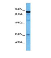Western blot of Human Esophagus Tumor. MARCH2 antibody dilution 1.0 ug/ml.