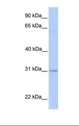 Jurkat cell lysate. Antibody concentration: 1.0 ug/ml. Gel concentration: 12%.