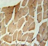 MARCH5 Antibody immunohistochemistry of formalin-fixed and paraffin-embedded human skeletal muscle followed by peroxidase-conjugated secondary antibody and DAB staining.