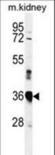 Western blot of MARCH5 Antibody in mouse kidney tissue lysates (35 ug/lane). MARCH5 (arrow) was detected using the purified antibody.