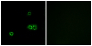 Immunofluorescence of A549 cells, using MARCH5 Antibody. The picture on the right is treated with the synthesized peptide.
