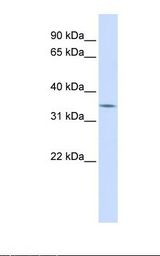 Fetal liver lysate. Antibody concentration: 1.0 ug/ml. Gel concentration: 12%.